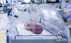 为什么有些早产儿比正常出生的孩子发育的慢？