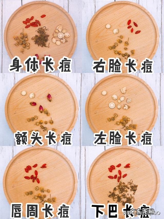 脸上总长白色的痘痘，一碰就很疼，该怎么办？