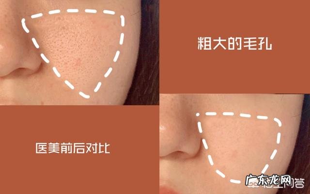 皮肤怎样保养才能变得细腻