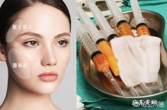 做自体脂肪填充要注意什么？