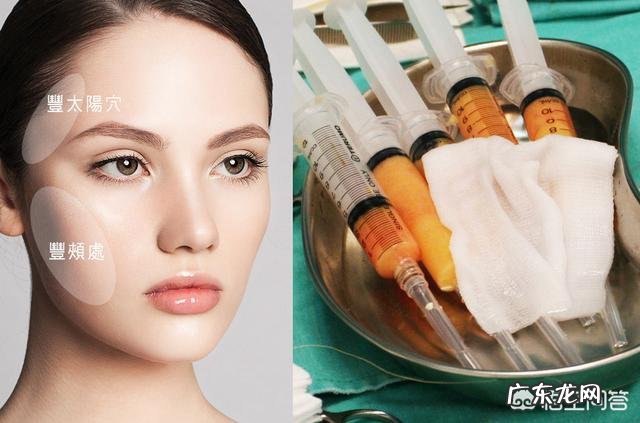 做自体脂肪填充要注意什么?