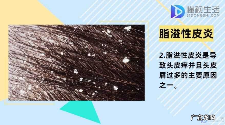 头上痒痒一扣有厚厚的头皮屑？ 头皮屑多是什么原因