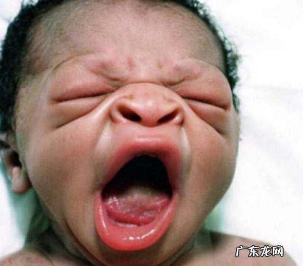 新生儿宝宝丑图-初生婴儿丑照