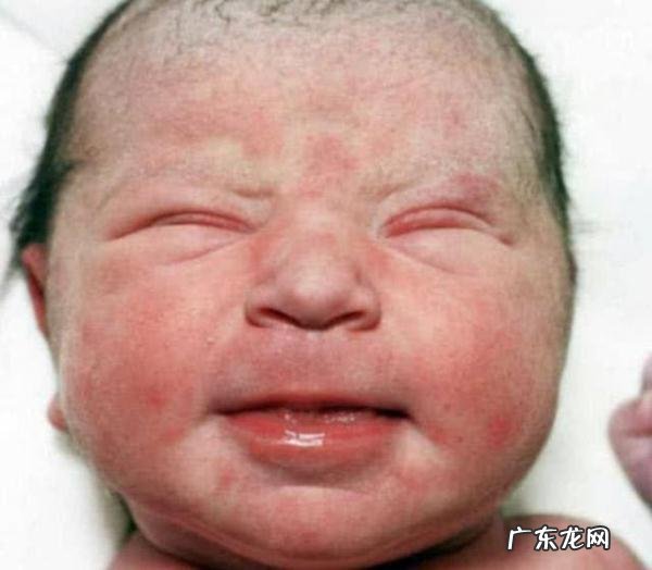 新生儿宝宝丑图-初生婴儿丑照