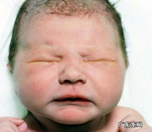 新生儿宝宝丑图-初生婴儿丑照