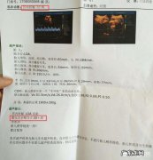 孕32周，胎儿偏小两周，怎么补胎呢？