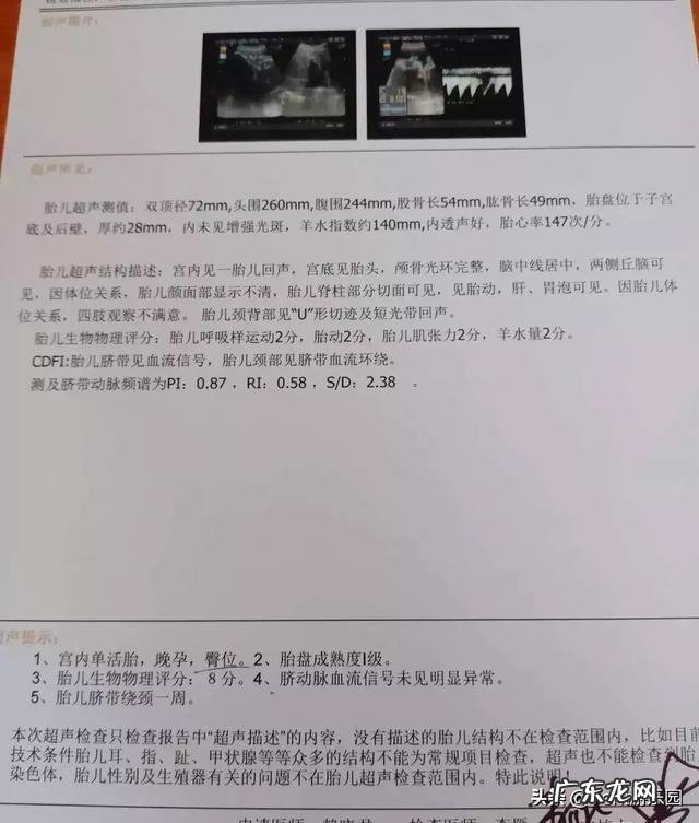 产后肚子大、腰粗、大腿粗，有哪些有效的瘦身方法？