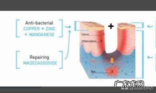 脸上的痘印为什么很久都不会消有哪些原因