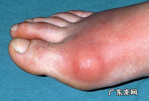 人到50,应该注意哪些方面