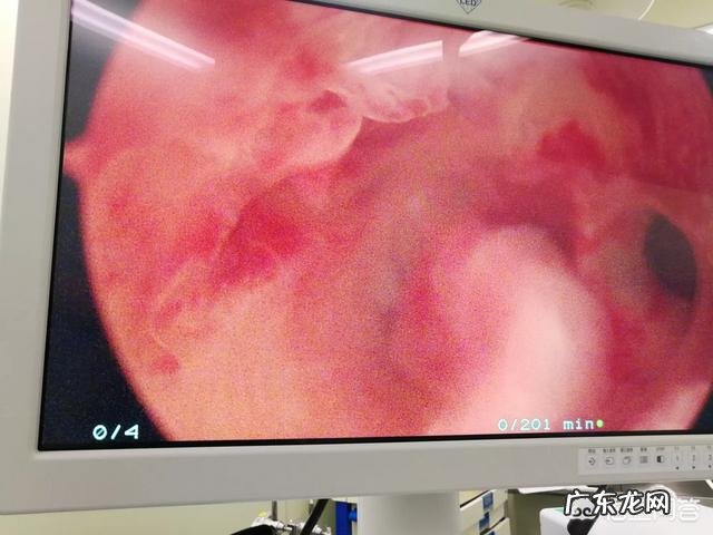 现在月经失调,那么想要孩子的时候再调理月经可以吗?