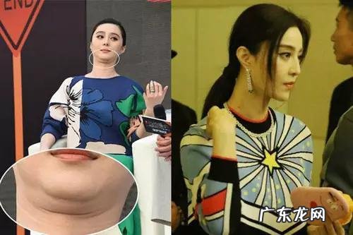 减肥30斤之后没毅力了怎么办?身上的蝴蝶袖和双下巴该怎么减?