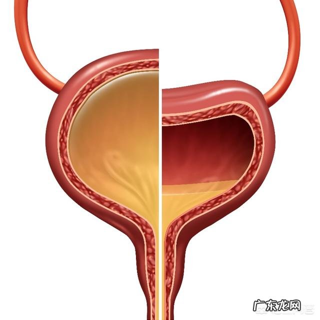 一喝水就有尿的人和喝水多没尿的人,谁更健康尿多是肾不好吗