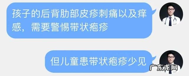 儿童皮疹的症状与治疗方法-孩子皮疹反复出现