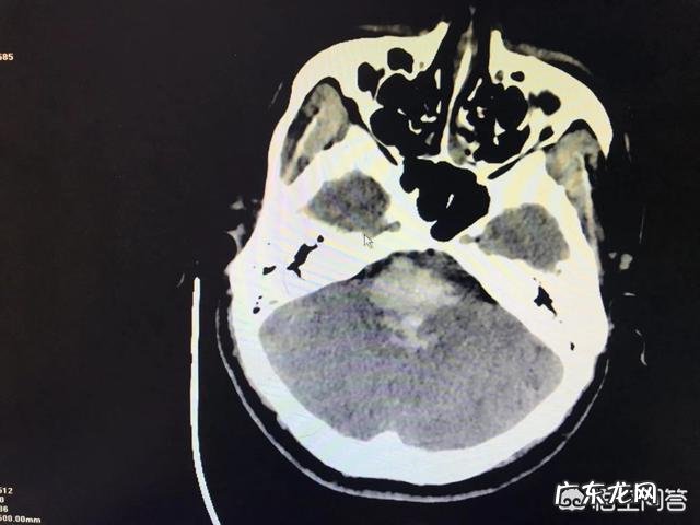 长期喝饮料会引起癌症和白血病吗？