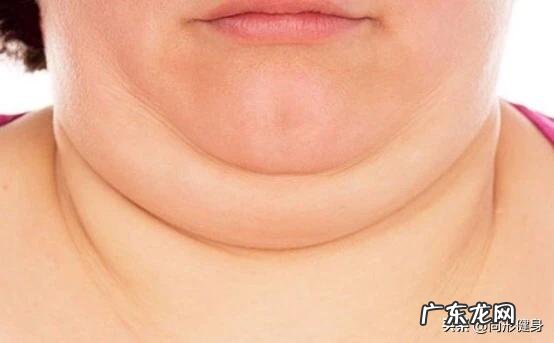 脖子黑怎么也洗不掉是什么情况 脖子黑黑的总洗不掉是怎么回事?