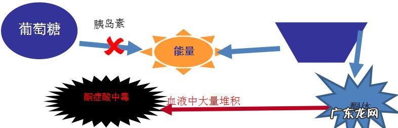 酮症酸中毒会出现血酮体 糖尿病出现酮体是否是糖尿病酮症酸中毒可能性?