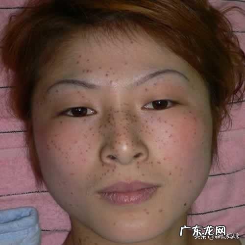 产后用什么护肤，生了孩子脸上就有斑了，用什么护肤品祛斑好呢？