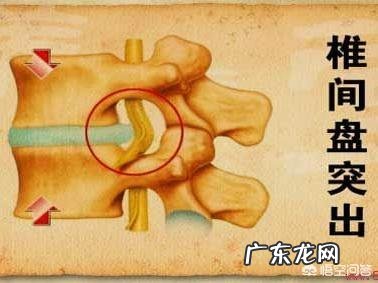 脑梗来了，头部会出现哪些征兆？