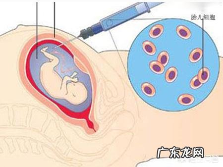 羊水穿刺结果异常必须做引产吗
