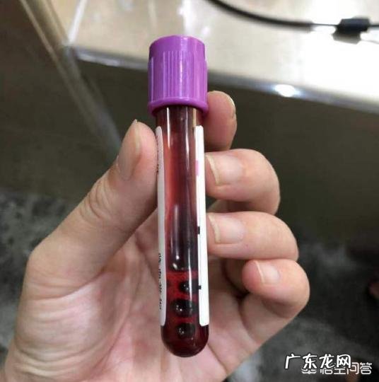 怀孕的人应该在多少周去医院建档合适