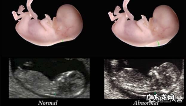 减肥之后有哪些尴尬的事？