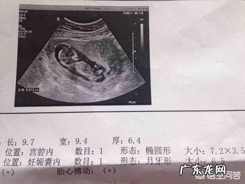 减肥之后有哪些尴尬的事？