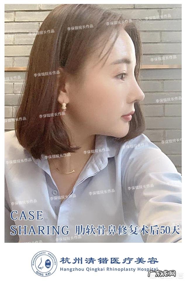 隆鼻的康复期是多长时间啊?