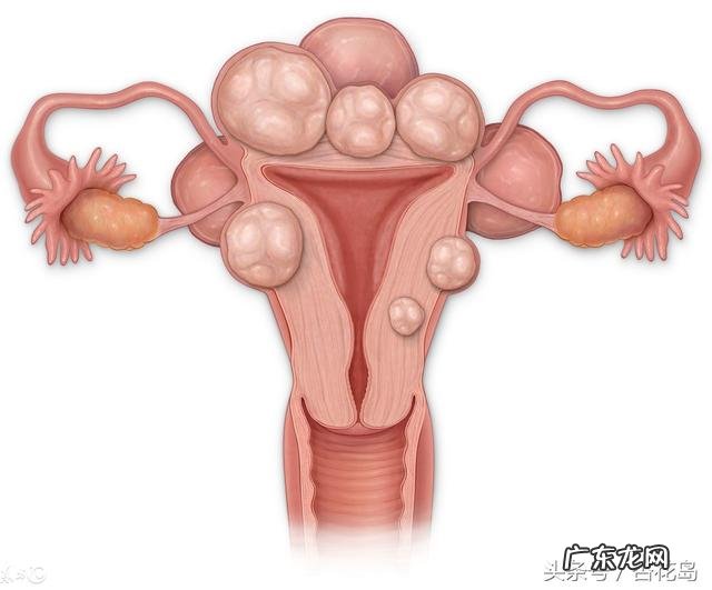 多囊促排对孕妇和胎儿有哪些影响?