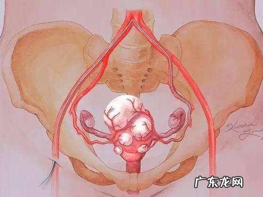 子宫肌瘤患者需要注意哪些忌口?