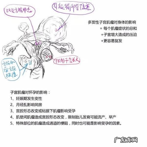 子宫肌瘤患者需要注意哪些忌口?