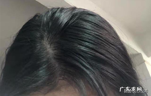 头发两天不洗就出油是怎么回事，该如何解决