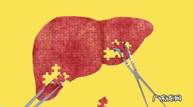 如何区分肝硬化的轻重程度?
