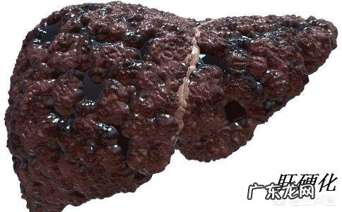 如何区分肝硬化的轻重程度?