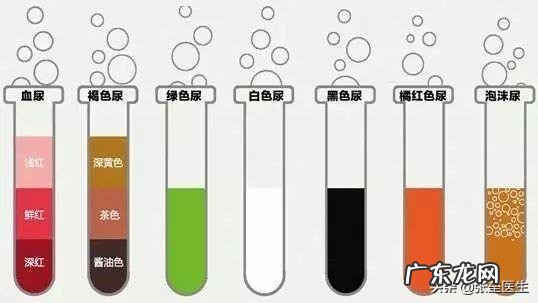 不同颜色尿液是否预示不同疾病?