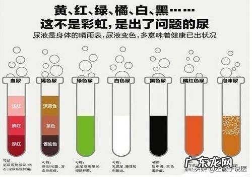 不同颜色尿液是否预示不同疾病?