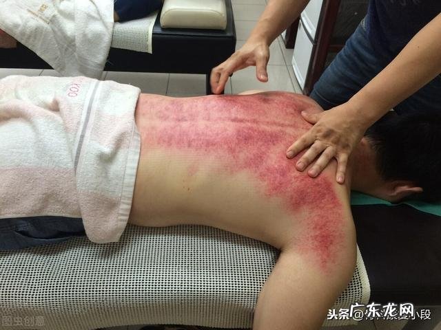 用经络刷刷带脉有瘀青是怎么回事啊