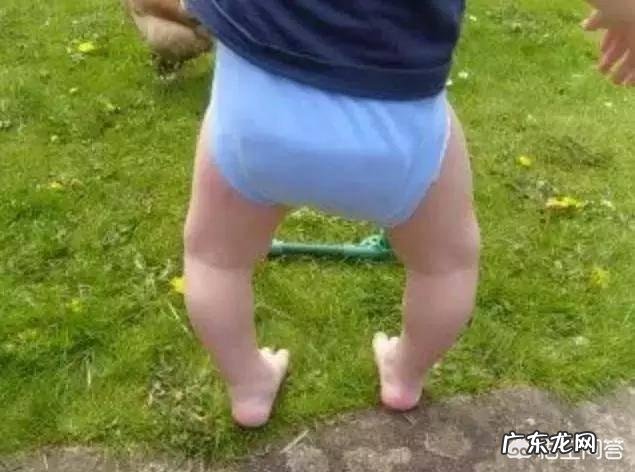 一岁宝宝腿像是o型怎么办