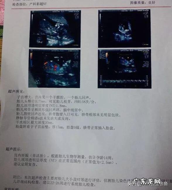 疫情期间,孕妇可以去做产检吗需要注意什么