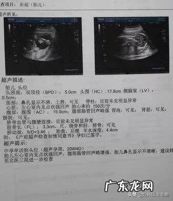 疫情期间,孕妇可以去做产检吗需要注意什么