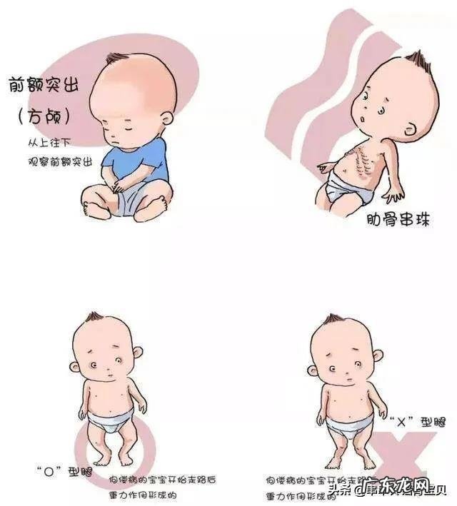 如何促进孩子骨骼发育,有哪些方法