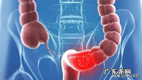 不想得癌症需要把哪些不良习惯改掉?请举例说出几种?