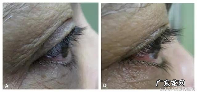 人大概在什么年龄段会开始眼花