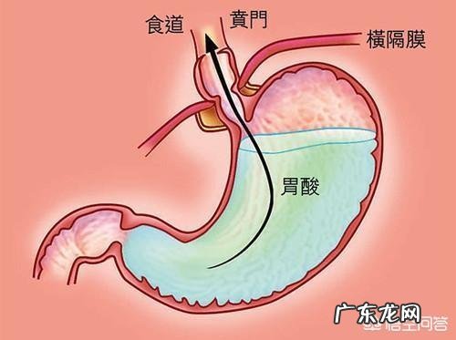 反流性食管炎会复发吗如何预防复发
