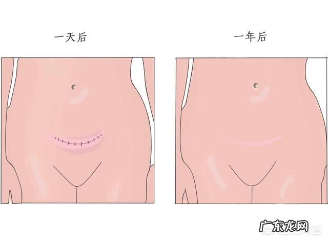 ′?ω?` 抖音电动呼啦圈能减肥吗?原理是什么?