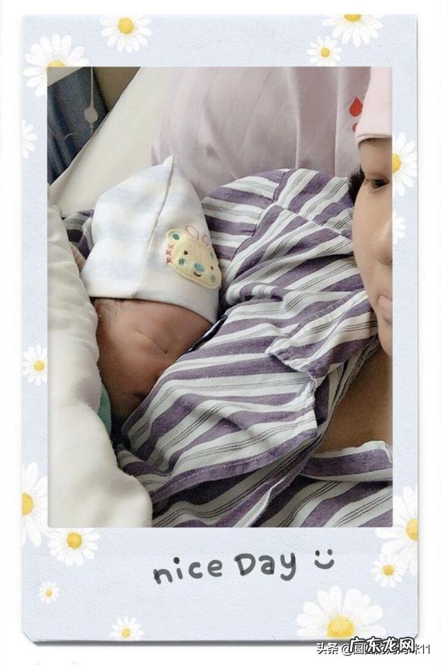 剖腹产怎么护理?母乳喂养可以减肥吗?