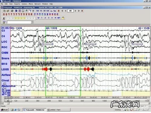 为什么有人说患有抑郁症的人会早醒