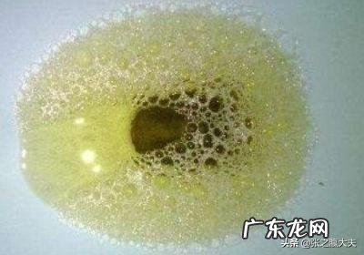 一喝酒，尿就多，是不是肾不好了？