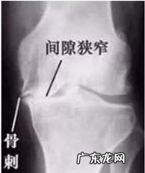 普通人适合冬天做的运动 冬天适合做什么样体育运动?