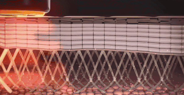 30多岁的女生有法令纹，面部开始松弛怎么办？