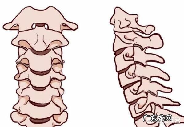 颈椎病会引起左腿麻么 颈椎病会引发大腿发麻吗，是怎么回事？